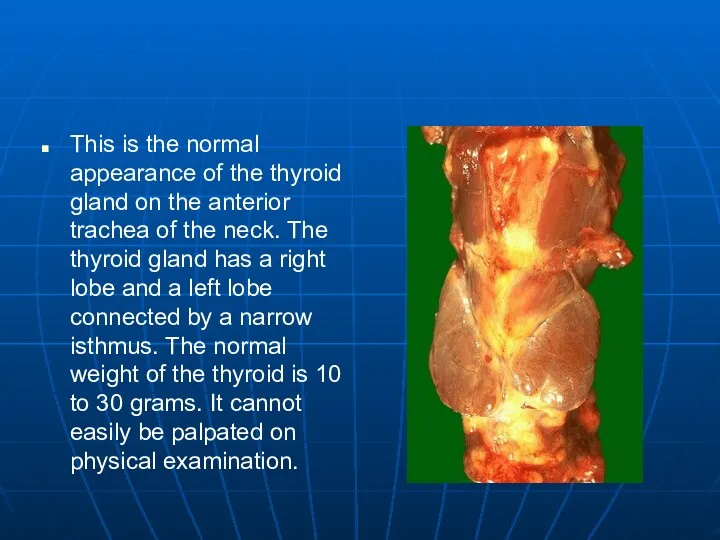 This is the normal appearance of the thyroid gland on