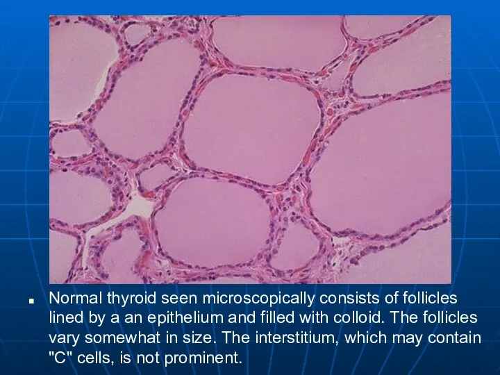 Normal thyroid seen microscopically consists of follicles lined by a