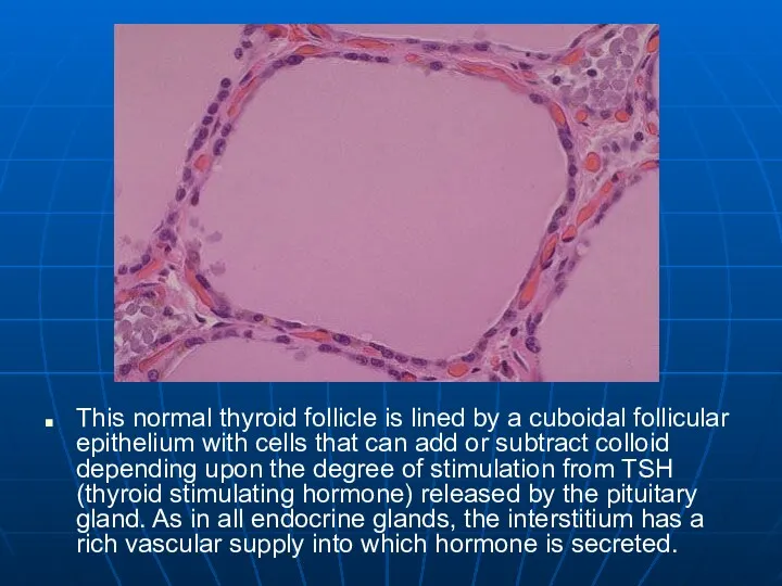 This normal thyroid follicle is lined by a cuboidal follicular