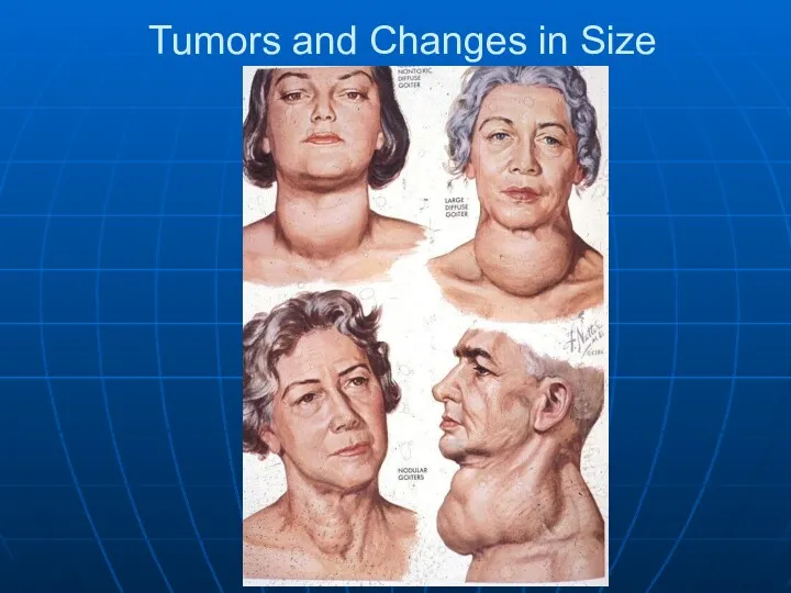 Tumors and Changes in Size