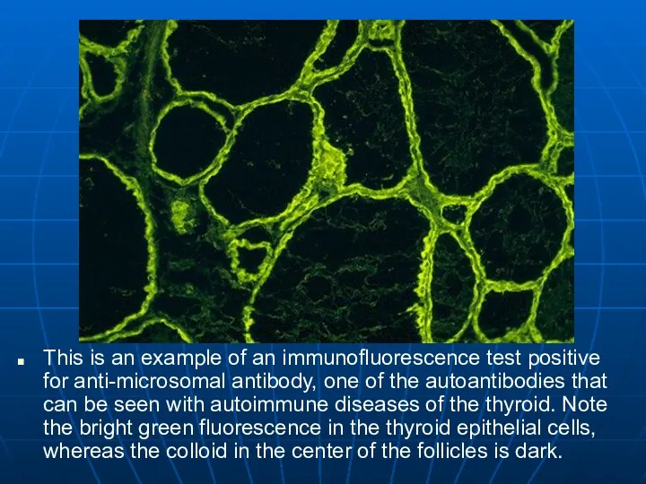 This is an example of an immunofluorescence test positive for