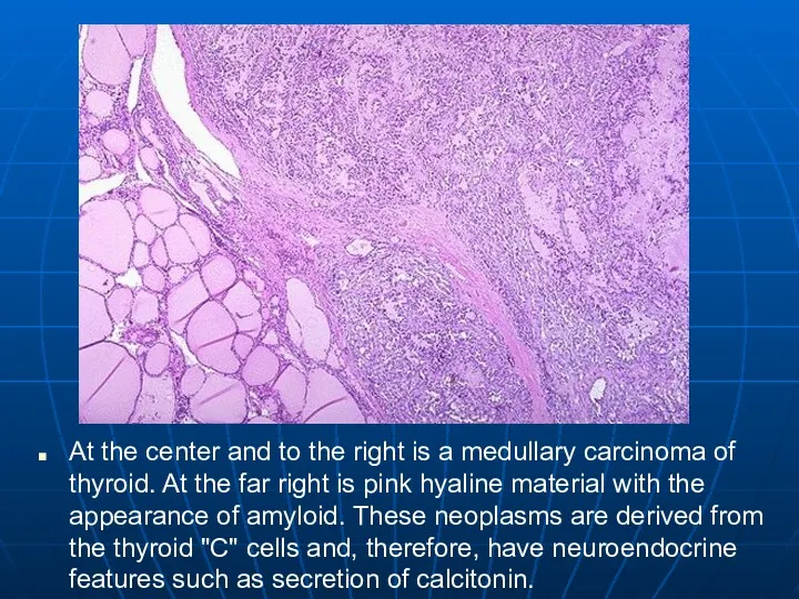 At the center and to the right is a medullary