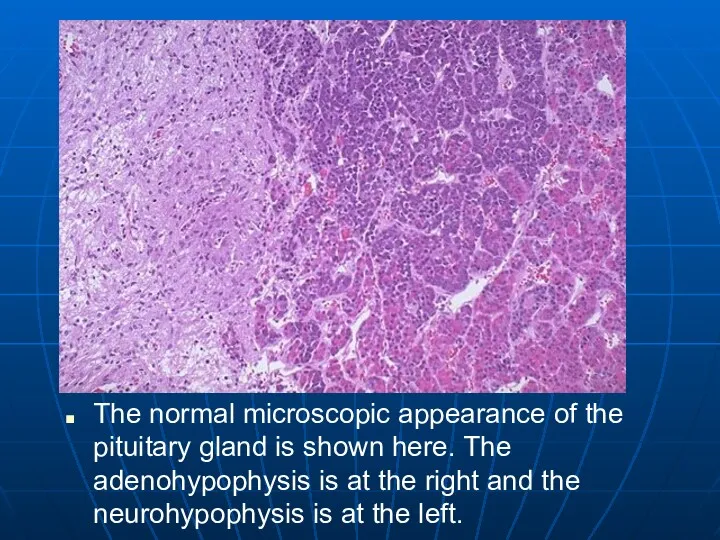 The normal microscopic appearance of the pituitary gland is shown