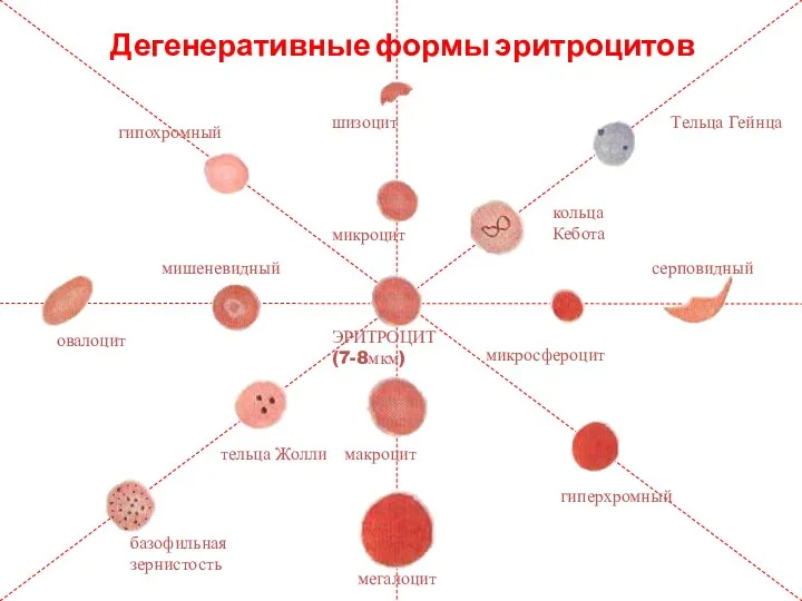 Дегенеративные формы эритроцитов