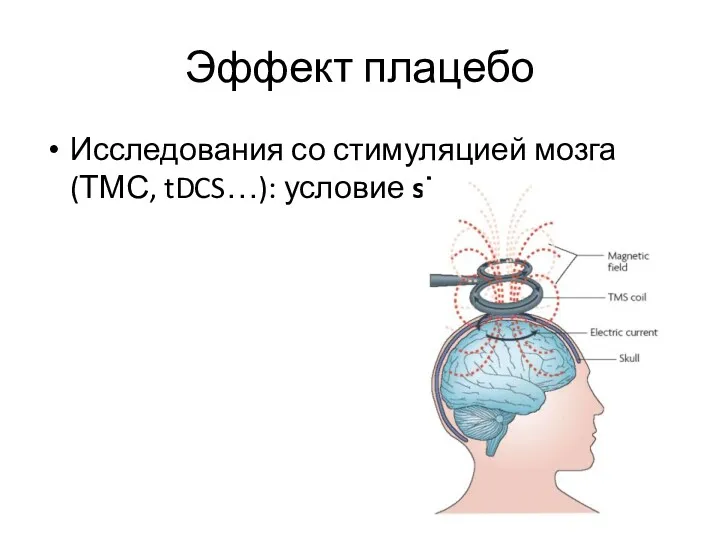 Эффект плацебо Исследования со стимуляцией мозга (ТМС, tDCS…): условие sham