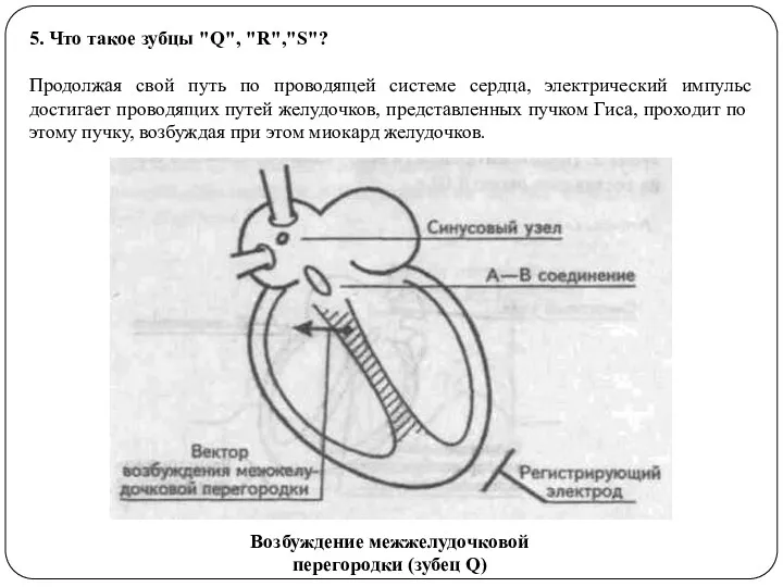 5. Что такое зубцы "Q", "R","S"? Продолжая свой путь по