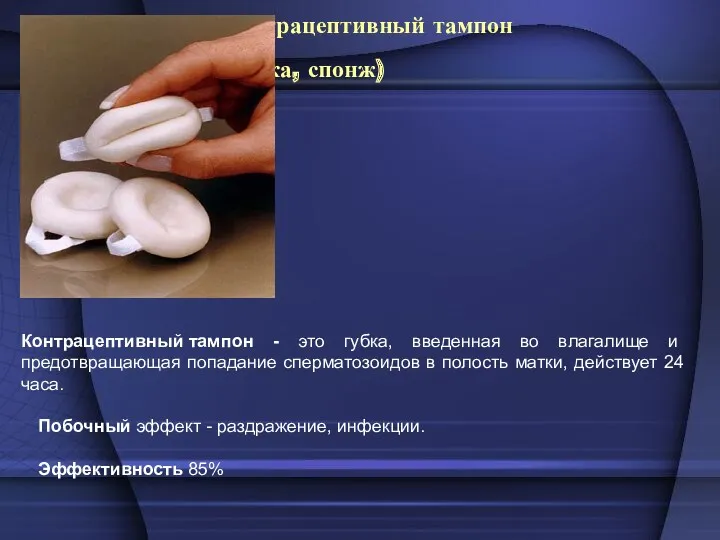 Контрацептивный тампон (губка, спонж) Контрацептивный тампон - это губка, введенная