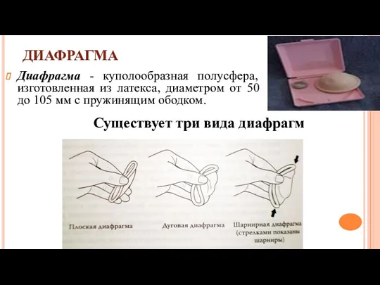 ДИАФРАГМА Диафрагма - куполообразная полусфера, изготовленная из латекса, диаметром от