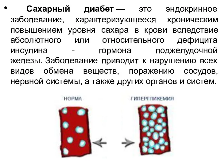 Сахарный диабет — это эндокринное заболевание, характеризующееся хроническим повышением уровня