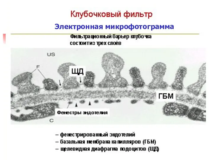 Электронная микрофотограмма