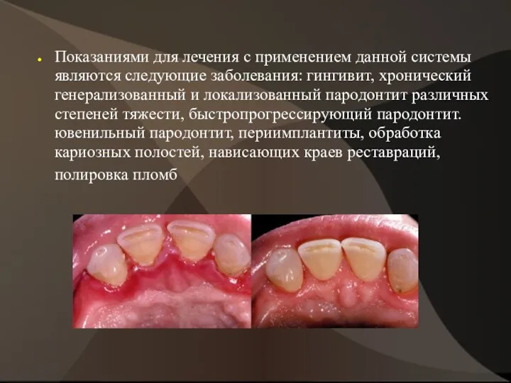 Показаниями для лечения с применением данной системы являются следующие заболевания: