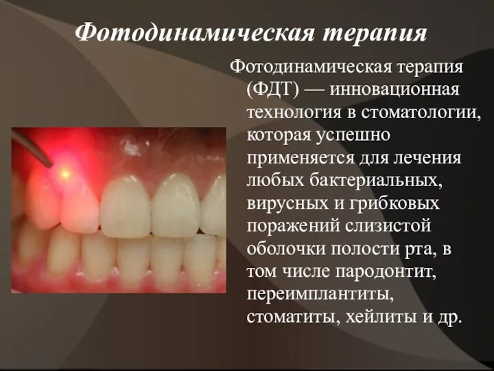 Фотодинамическая терапия Фотодинамическая терапия (ФДТ) — инновационная технология в стоматологии,