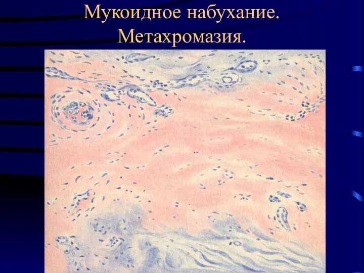 Мукоидное набухание. Метахромазия.