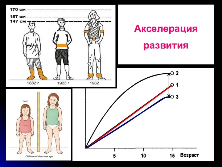 Акселерация развития