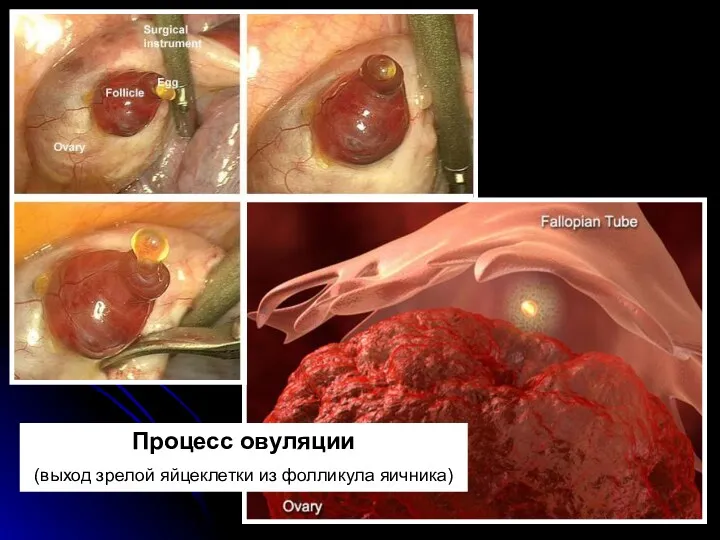 Процесс овуляции (выход зрелой яйцеклетки из фолликула яичника)