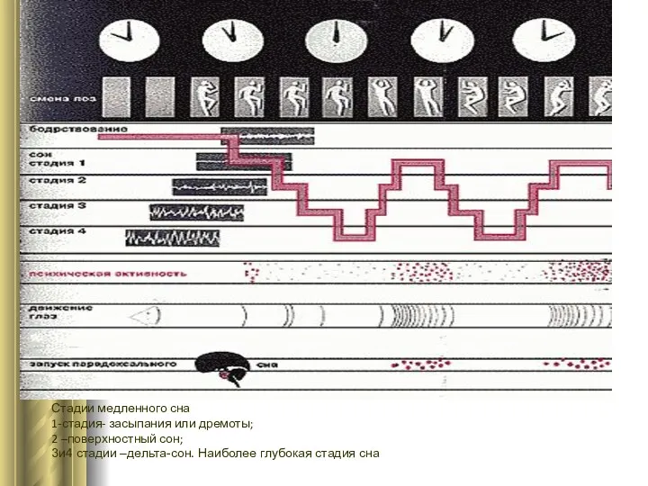 Стадии медленного сна 1-стадия- засыпания или дремоты; 2 –поверхностный сон;