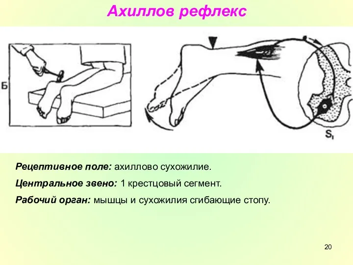 Ахиллов рефлекс Рецептивное поле: ахиллово сухожилие. Центральное звено: 1 крестцовый