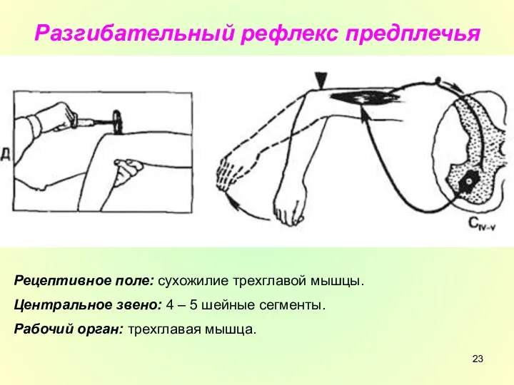 Разгибательный рефлекс предплечья Рецептивное поле: сухожилие трехглавой мышцы. Центральное звено: