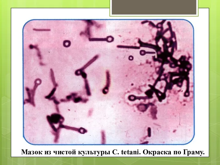 Мазок из чистой культуры С. tetani. Окраска по Граму.