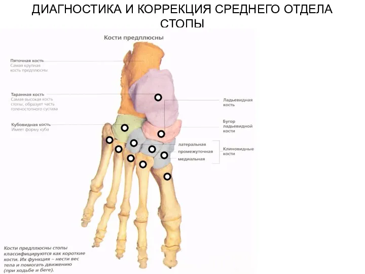 ДИАГНОСТИКА И КОРРЕКЦИЯ СРЕДНЕГО ОТДЕЛА СТОПЫ