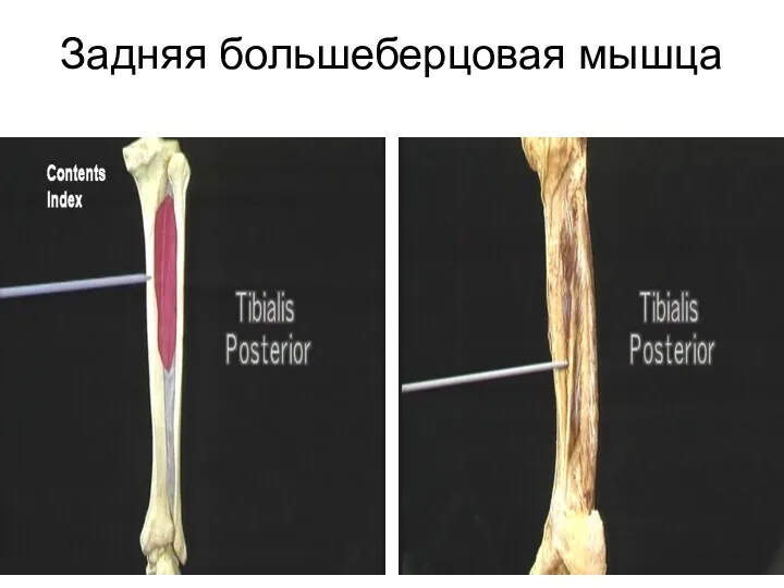 Задняя большеберцовая мышца