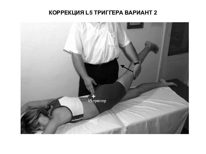 КОРРЕКЦИЯ L5 ТРИГГЕРА ВАРИАНТ 2