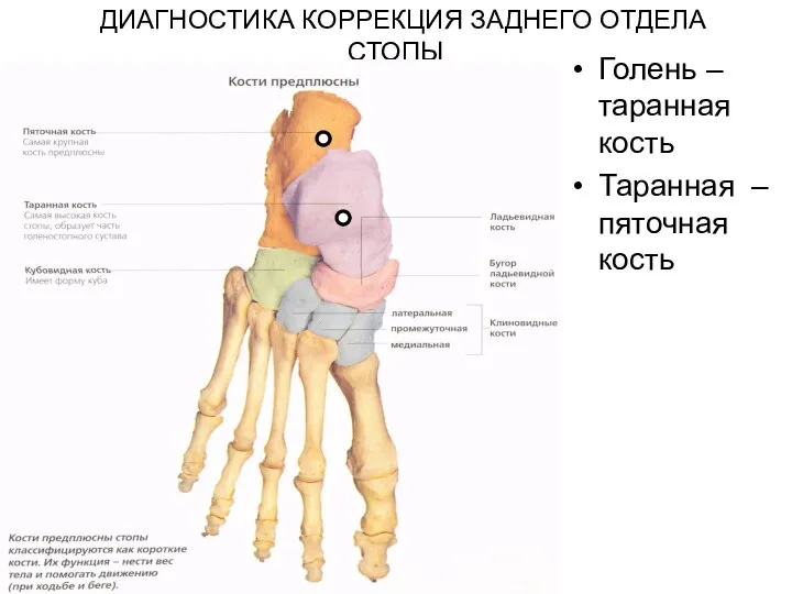 ДИАГНОСТИКА КОРРЕКЦИЯ ЗАДНЕГО ОТДЕЛА СТОПЫ Голень – таранная кость Таранная – пяточная кость