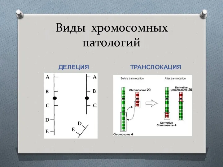 Виды хромосомных патологий ДЕЛЕЦИЯ ТРАНСЛОКАЦИЯ