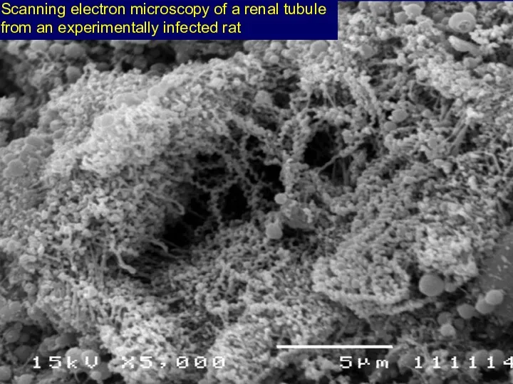 Scanning electron microscopy of a renal tubule from an experimentally infected rat