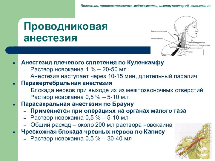 Проводниковая анестезия Анестезия плечевого сплетения по Куленкамфу Раствор новокаина 1