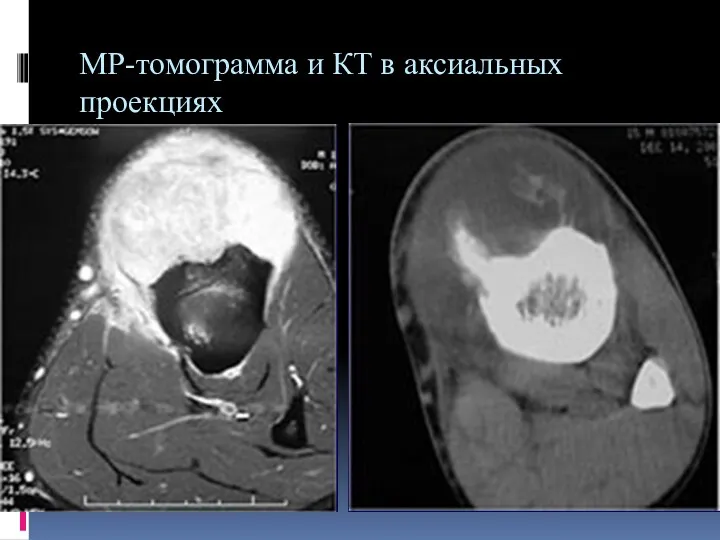 МР-томограмма и КТ в аксиальных проекциях