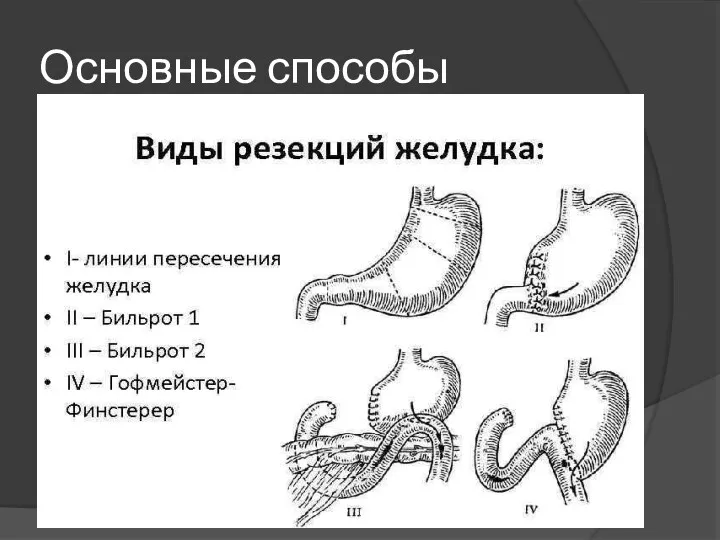 Основные способы