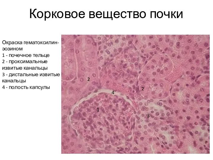 Корковое вещество почки Окраска гематоксилин-эозином 1 - почечное тельце 2