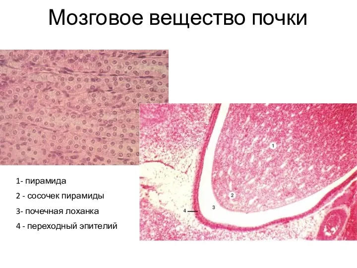 Мозговое вещество почки 1- пирамида 2 - сосочек пирамиды 3- почечная лоханка 4 - переходный эпителий