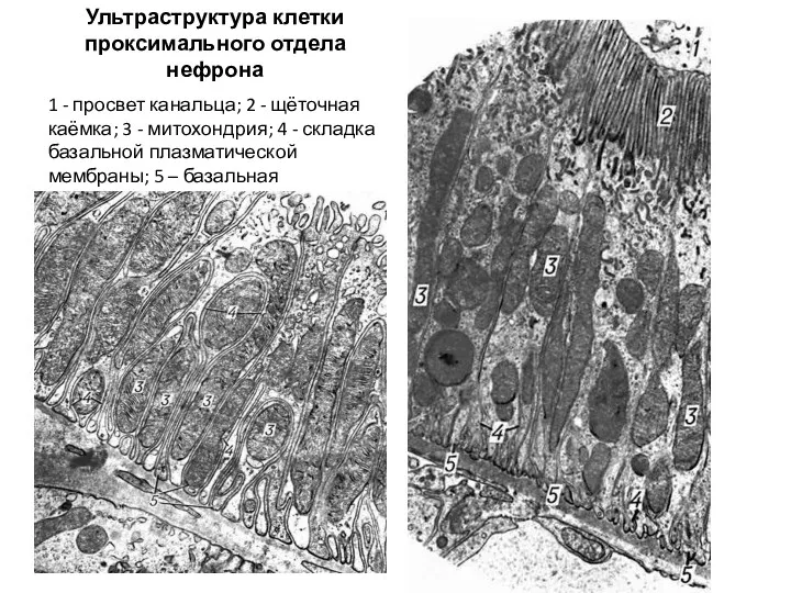 Ультраструктура клетки проксимального отдела нефрона 1 - просвет канальца; 2