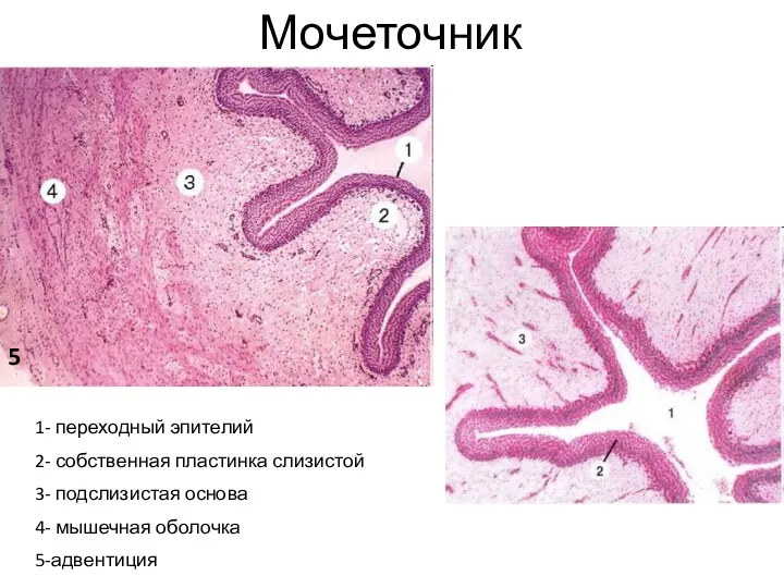 Мочеточник 1- переходный эпителий 2- собственная пластинка слизистой 3- подслизистая основа 4- мышечная оболочка 5-адвентиция 5