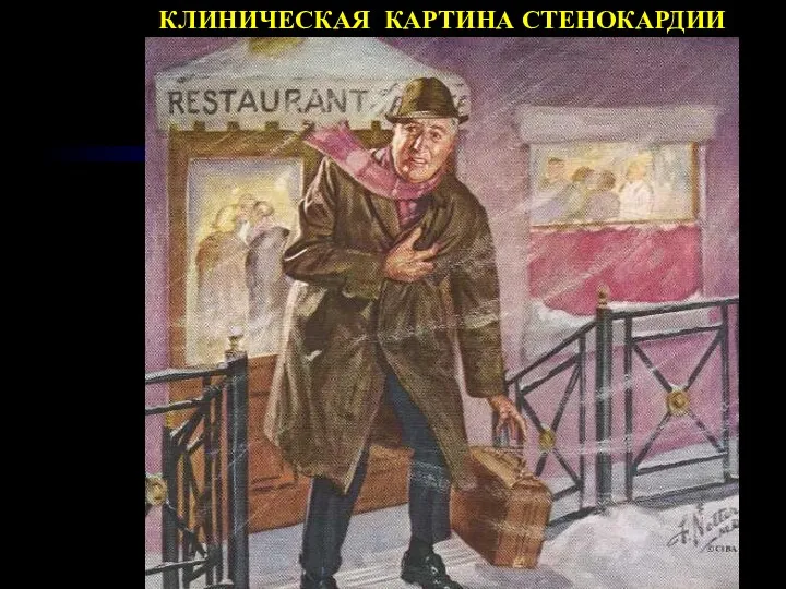 КЛИНИЧЕСКАЯ КАРТИНА СТЕНОКАРДИИ