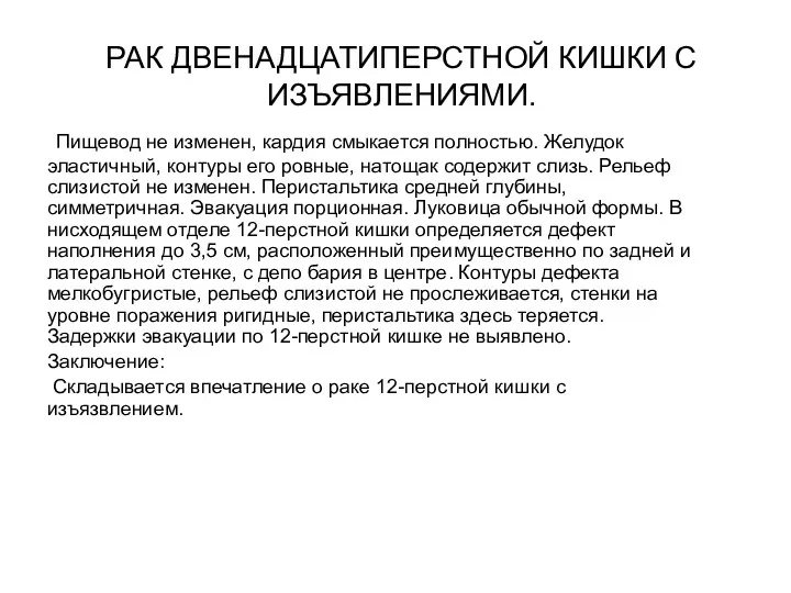 РАК ДВЕНАДЦАТИПЕРСТНОЙ КИШКИ С ИЗЪЯВЛЕНИЯМИ. Пищевод не изменен, кардия смыкается