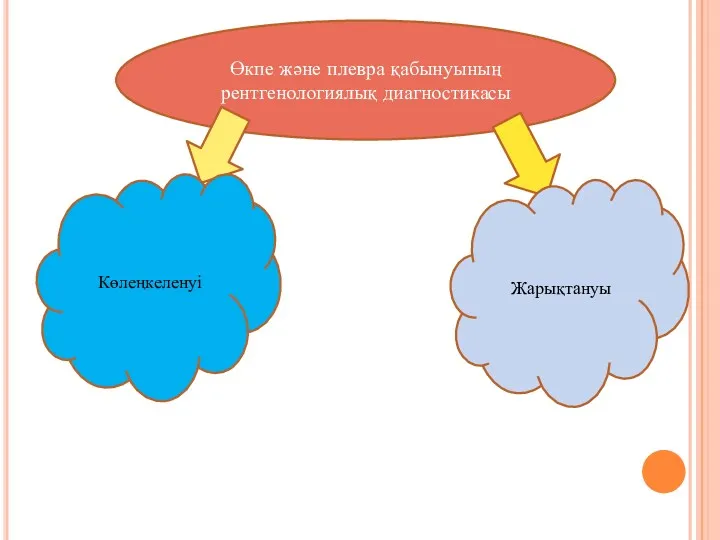 Өкпе және плевра қабынуының рентгенологиялық диагностикасы Көлеңкеленуі Жарықтануы