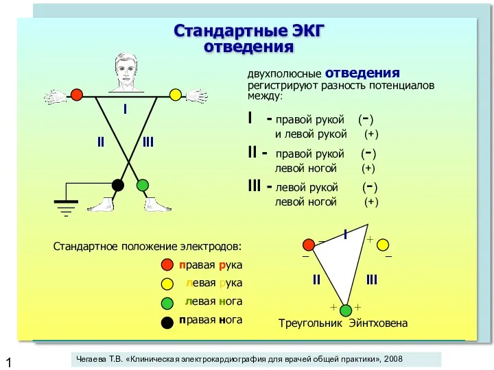 двухполюсные отведения регистрируют разность потенциалов между: I - правой рукой