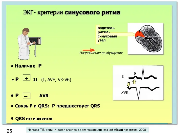 водитель ритма- синусовый узел ЭКГ- критерии синусового ритма Р II