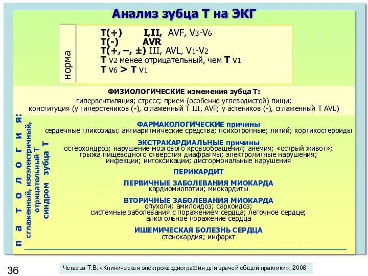 Анализ зубца Т на ЭКГ Т(+) I,II, AVF, V3-V6 Т(-)