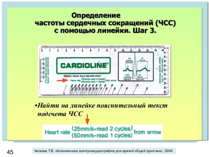 Найти на линейке пояснительный текст подсчета ЧСС Определение частоты сердечных