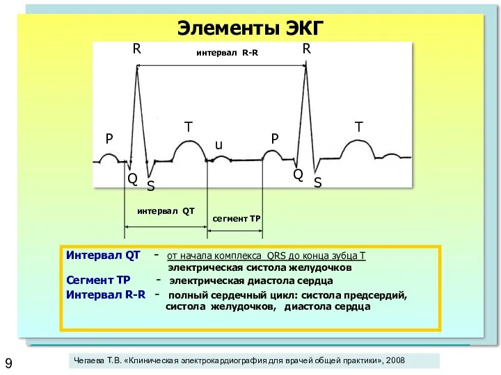 P R R интервал R-R T P T u Q