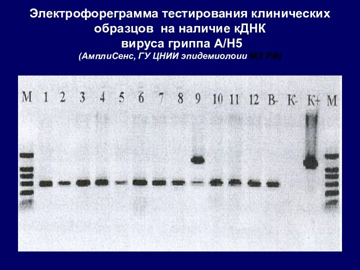 Электрофореграмма тестирования клинических образцов на наличие кДНК вируса гриппа А/Н5 (АмплиСенс, ГУ ЦНИИ эпидемиолоии МЗ РФ)