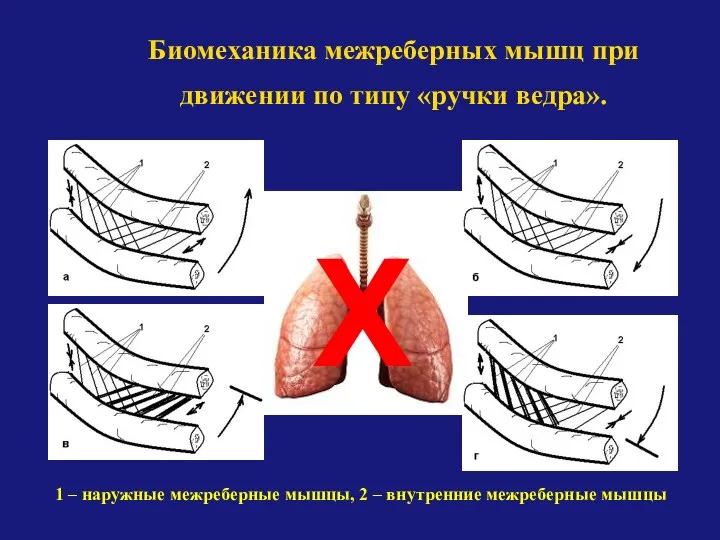 Биомеханика межреберных мышц при движении по типу «ручки ведра». 1