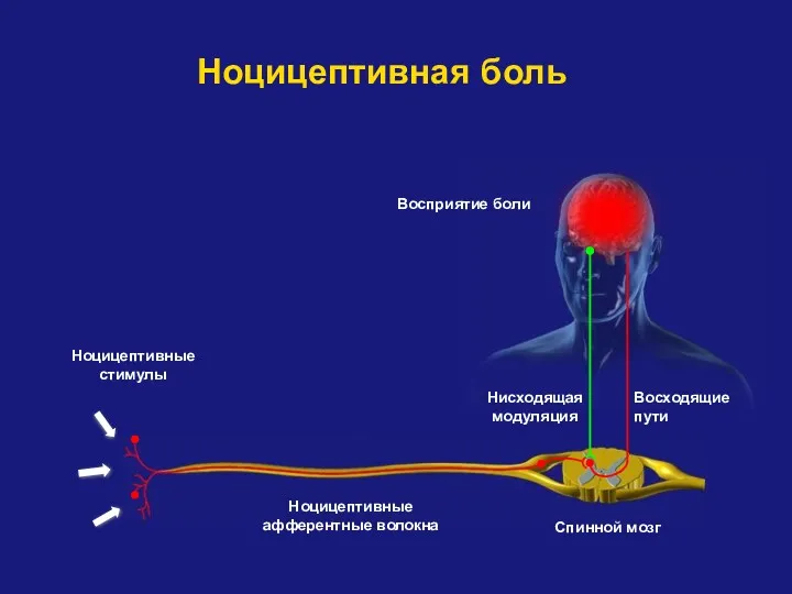 Ноцицептивные афферентные волокна Ноцицептивная боль Нисходящая модуляция Восходящие пути Спинной мозг Восприятие боли