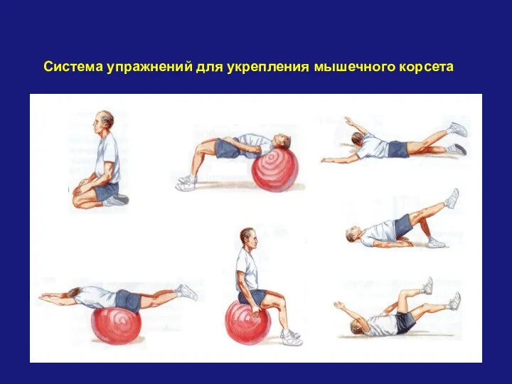 Система упражнений для укрепления мышечного корсета
