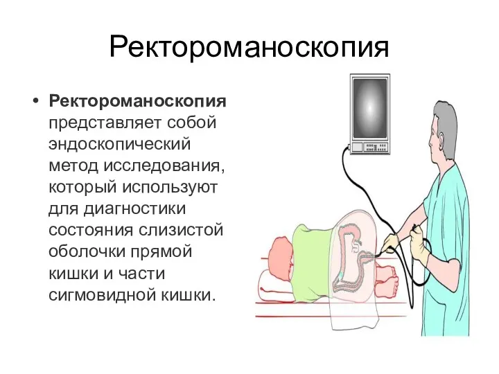 Ректороманоскопия Ректороманоскопия представляет собой эндоскопический метод исследования, который используют для