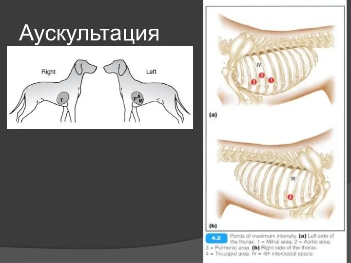 Аускультация